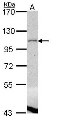 Western Blot: Lipin 1 Antibody [NBP2-19370]