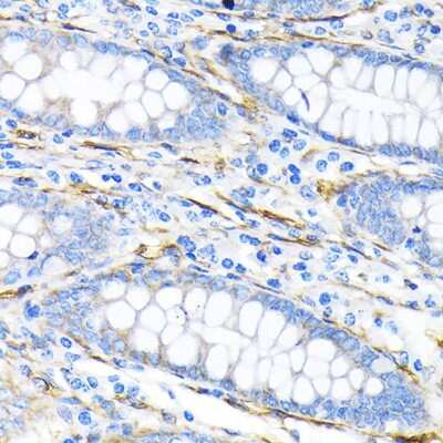 Immunohistochemistry-Paraffin: LPP Antibody (8M2R8) [NBP3-15690]