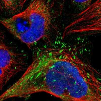 Immunocytochemistry/ Immunofluorescence: LPP Antibody [NBP1-89555]