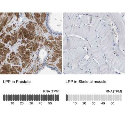 Immunohistochemistry-Paraffin: LPP Antibody [NBP1-89549]
