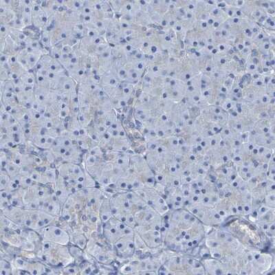 Immunohistochemistry-Paraffin: LPP Antibody [NBP1-89555]