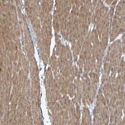 Immunohistochemistry-Paraffin: LPP Antibody [NBP1-89555]