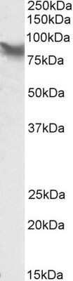 Western Blot: LPP Antibody [NBP1-46145]