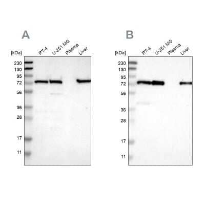 Western Blot: LPP Antibody [NBP1-89549]