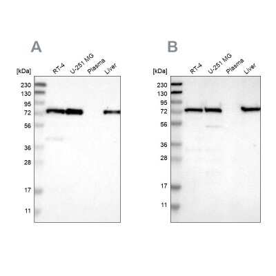 Western Blot: LPP Antibody [NBP1-89555]