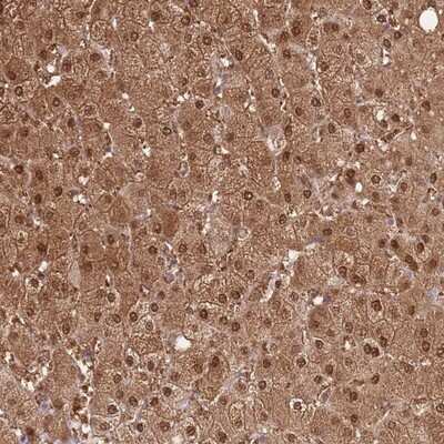 Immunohistochemistry-Paraffin: LPPR2 Antibody [NBP2-14253]