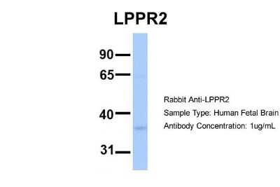 Western Blot: LPPR2 Antibody [NBP1-62301]