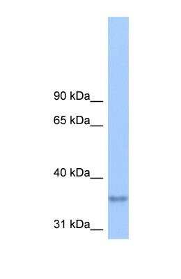 Western Blot: LPPR2 Antibody [NBP1-69329]