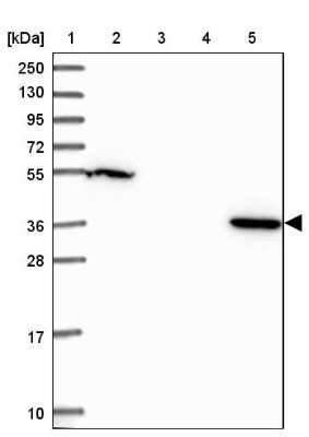 Western Blot: LPPR2 Antibody [NBP2-14253]