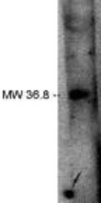 Western Blot: LPPR2 Antibody [NBP3-11907]