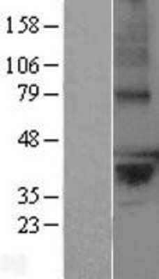 Western Blot: LPPR2 Overexpression Lysate [NBL1-12657]