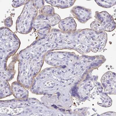 Immunohistochemistry-Paraffin: LPPR3 Antibody [NBP2-33645]