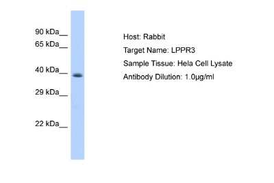 Western Blot: LPPR3 Antibody [NBP2-85223]