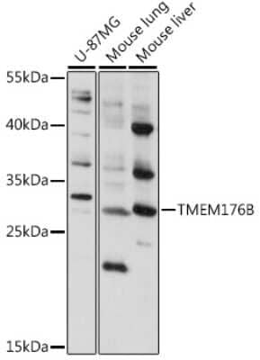 Western Blot: LR8 AntibodyAzide and BSA Free [NBP3-03489]