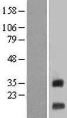 Western Blot: LR8 Overexpression Lysate [NBL1-17042]