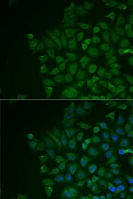 Immunocytochemistry/ Immunofluorescence: LRAT Antibody - BSA Free [NBP3-04496]