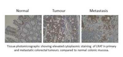 Immunohistochemistry: LRAT Antibody (M34-P1F10) - BSA Free [NBP2-50444]
