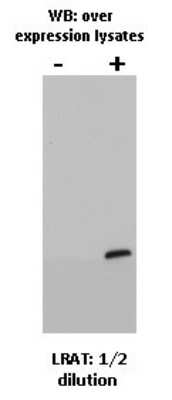 Western Blot: LRAT Antibody (M34-P1F10)BSA Free [NBP2-50444]