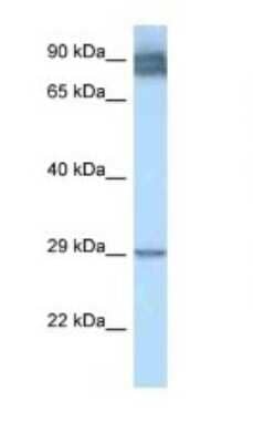 Western Blot: LRAT Antibody [NBP1-79775]