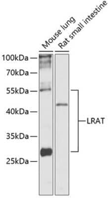 Western Blot: LRAT AntibodyBSA Free [NBP3-04496]