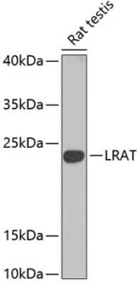 Western Blot: LRAT AntibodyBSA Free [NBP3-04497]