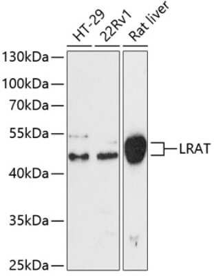 Western Blot: LRAT AntibodyAzide and BSA Free [NBP3-04954]