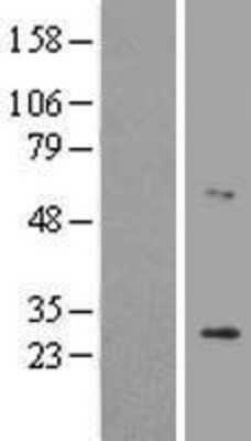 Western Blot: LRAT Overexpression Lysate [NBL1-12659]