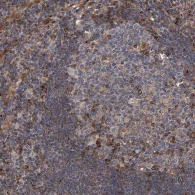 Immunohistochemistry-Paraffin: LRBA Antibody [NBP1-90764]