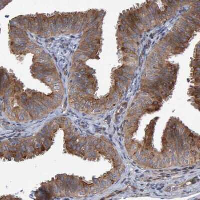 Immunohistochemistry-Paraffin: LRBA Antibody [NBP1-90764]