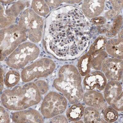 Immunohistochemistry-Paraffin: LRBA Antibody [NBP1-90764]