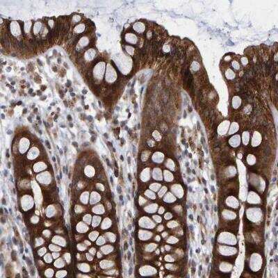 Immunohistochemistry-Paraffin: LRBA Antibody [NBP1-90764]