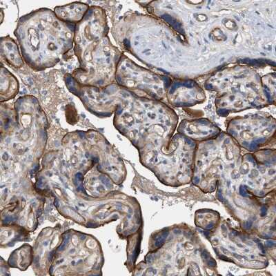 Immunohistochemistry-Paraffin: LRCH1 Antibody [NBP1-90629]