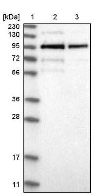 Western Blot: LRCH1 Antibody [NBP1-90629]