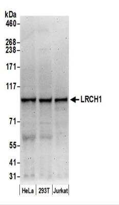 Western Blot: LRCH1 Antibody [NBP2-44281]