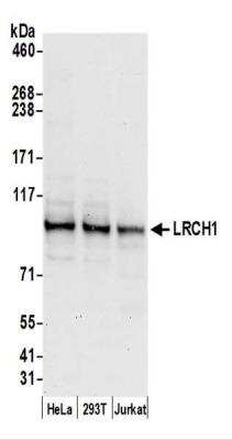 Western Blot: LRCH1 Antibody [NBP2-44282]