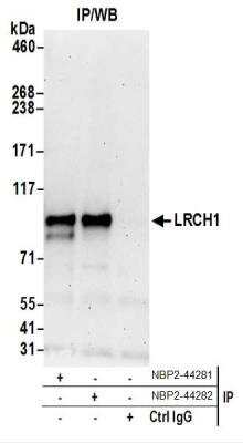 Western Blot: LRCH1 Antibody [NBP2-44282]