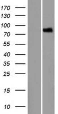 Western Blot: LRCH1 Overexpression Lysate [NBP2-07211]