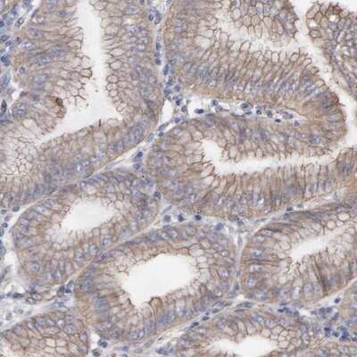 Immunohistochemistry-Paraffin: LRCH2 Antibody [NBP1-93588]