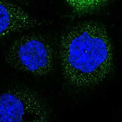 Immunocytochemistry/ Immunofluorescence: LRCH3 Antibody [NBP2-55087]