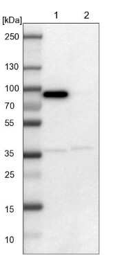 Western Blot: LRCH3 Antibody [NBP1-81083]