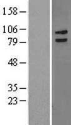 Western Blot: LRCH3 Overexpression Lysate [NBL1-12660]