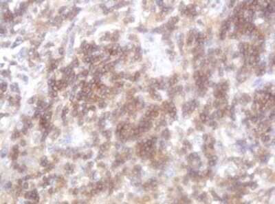 Immunohistochemistry: LRCH4 Antibody (OTI1F8) [NBP2-45795]