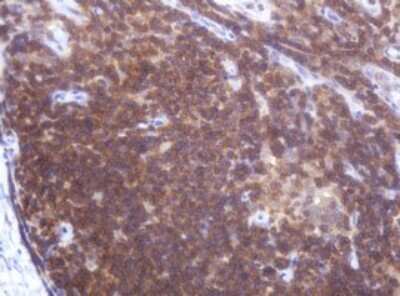 Immunohistochemistry: LRCH4 Antibody (OTI1F8) [NBP2-45795]