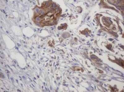 Immunohistochemistry: LRCH4 Antibody (OTI1F8) [NBP2-45795]