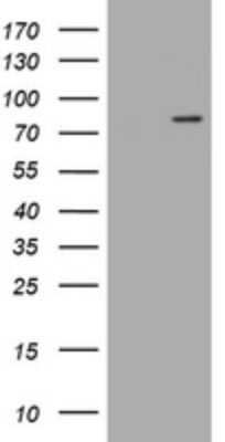 Western Blot: LRCH4 Antibody (OTI1F8) [NBP2-45795]