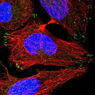 Immunocytochemistry/ Immunofluorescence: LRCH4 Antibody [NBP1-81288]