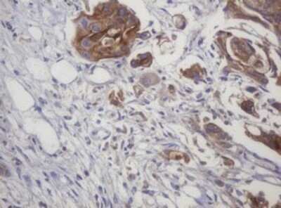 Immunohistochemistry: LRCH4 Antibody (OTI1F8) - Azide and BSA Free [NBP2-72520]