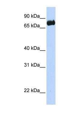 Western Blot: LRCH4 Antibody [NBP1-69264]