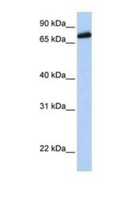 Western Blot: LRCH4 Antibody [NBP1-69265]