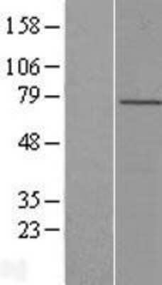 Western Blot: LRCH4 Overexpression Lysate [NBL1-12661]